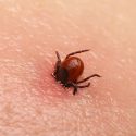 Experts Warn Of Increases In Tick-Borne Powassan Virus